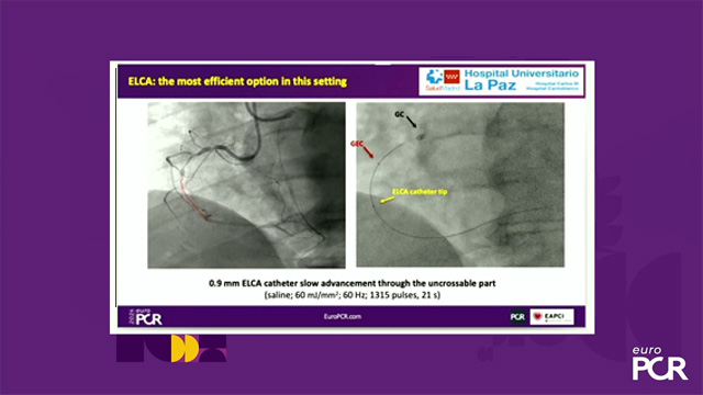 Solving challenging PCI with laser atherectomy; the forgotten Swiss knife?
