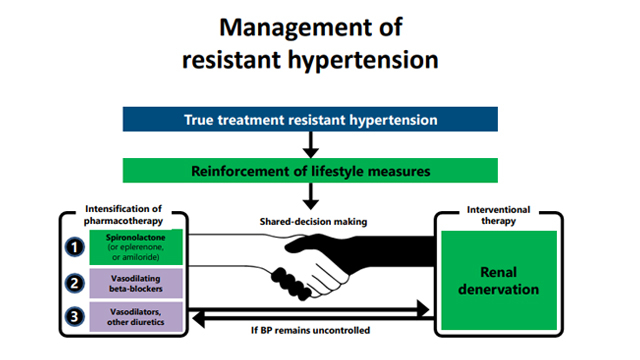 Successful implementation of renal denervation in hypertension management (the hardest part is getting started)