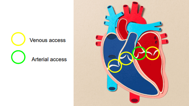 The landscape of structural heart interventions