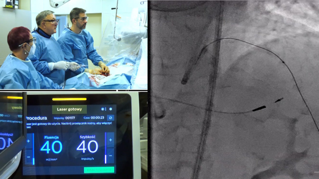 The uncrossable lesion