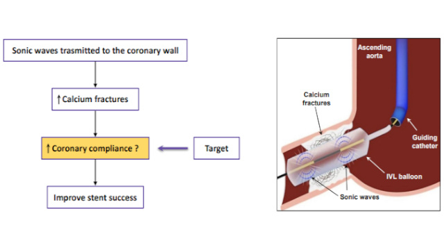 Treatment strategies of calcified lesions