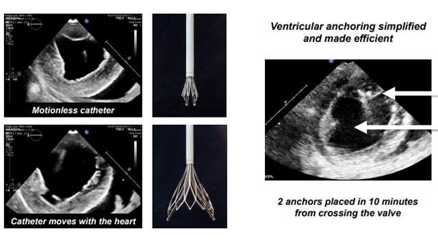 Valvular and structural interventions