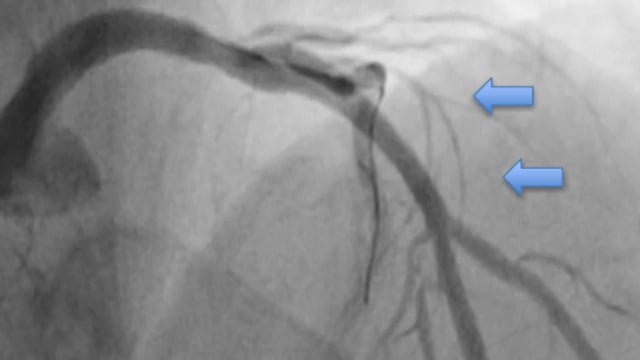 Complications and challenging cases #1