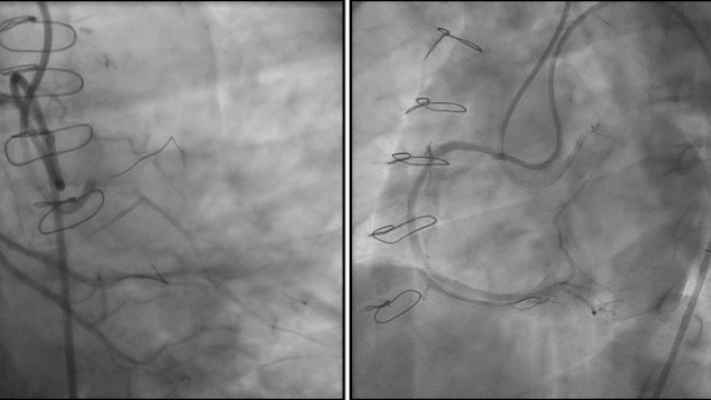 CTO PCI