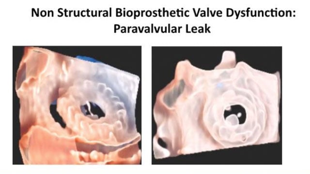 Comprehensive assessment of mitral valve disorders and treatment outcomes
