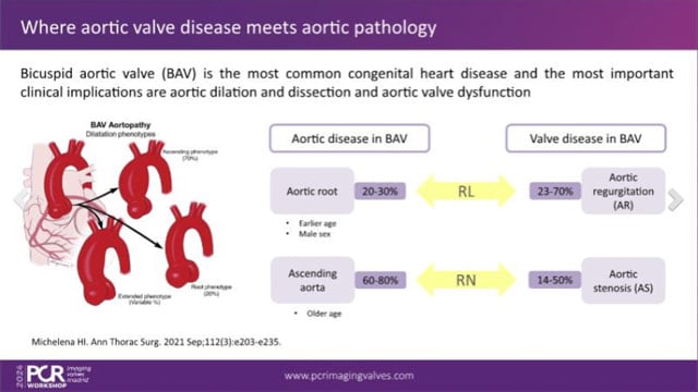 Multivalvular disease: diagnostic challenges and treatment strategies for aortic and mitral valve disorders