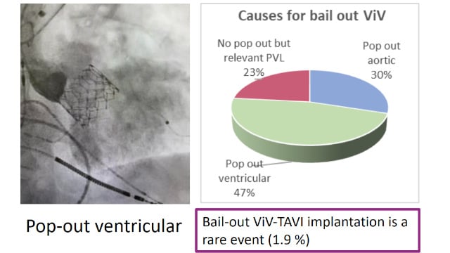 Featured research - Aortic valve (Part 11)
