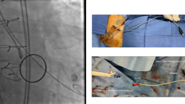 Featured research - Aortic valve (Part 2)