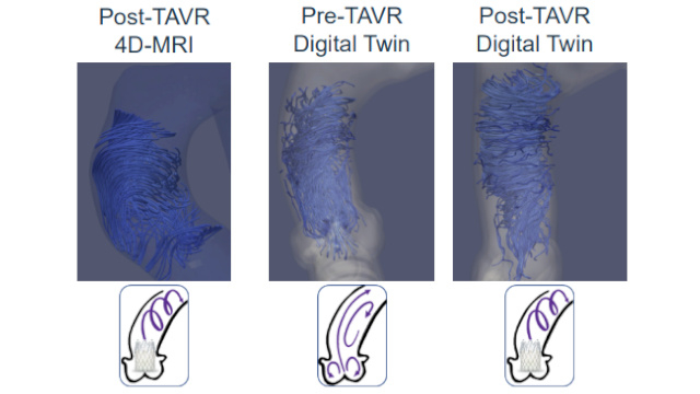 Featured research - Aortic valve (Part 4)