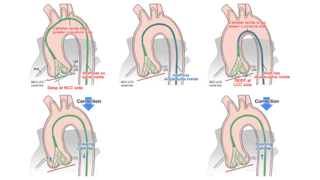Featured Research - Aortic valve (Part 9)
