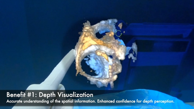 Mastering structural heart intervention with innovations in imaging