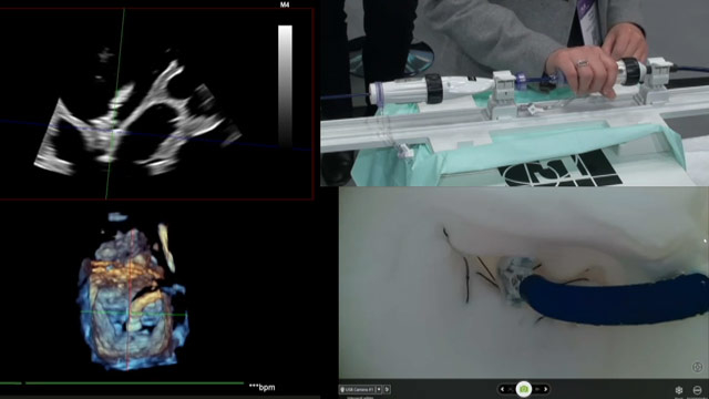 Transforming interventional care for patients with mitral regurgitation: simulation and case-based learning