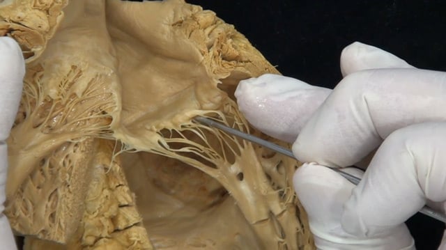Unlocking the potential of mitral and tricuspid valves clipping