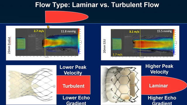Valve haemodynamics and long-term durability