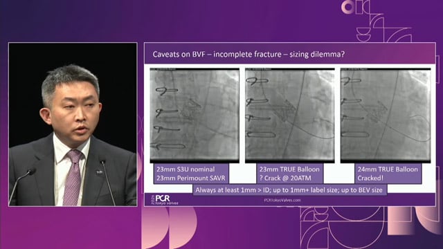 Contemporary techniques for TAV-in-SAV interventions