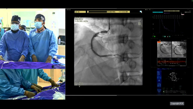 Stent failure - LIVE Case