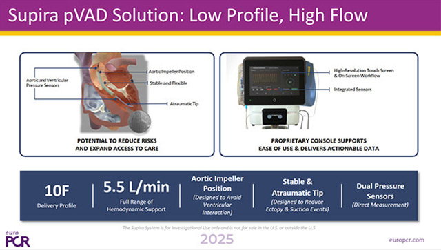 360 management of cardiogenic shock