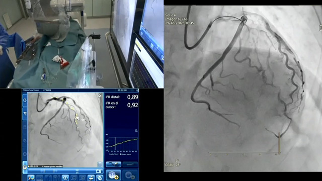 A mindset shift in the cathlab: leveraging contemporary technologies for planning and guiding PCI in complex patients