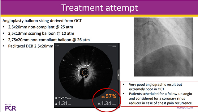 Challenging clinical scenarios in coronary artery disease