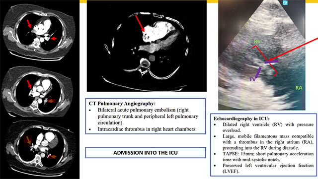 Challenging scenarios in the pulmonary system - Part 2