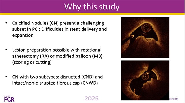 Choices, choices: a global perspective on multiple modalities for calcium modification