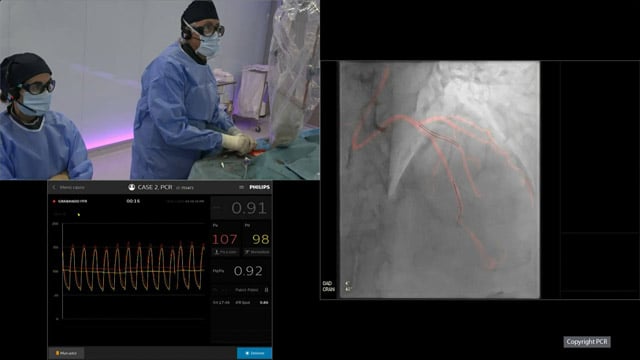 Complex multivessel disease - LIVE Case