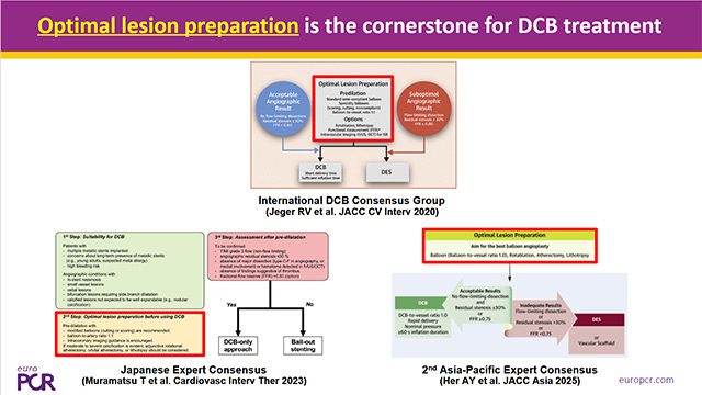 DCB and latest DES technology for coronary interventions
