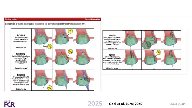 Degeneration of TAVI valves: a new target for innovations