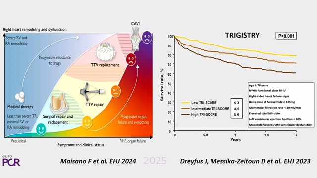How to build a tricuspid programme?