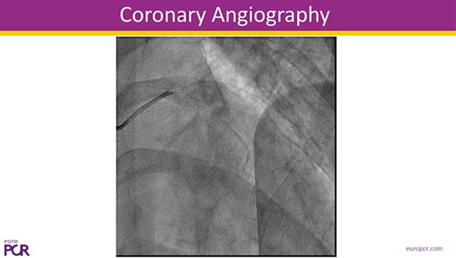 Imaging makes it clear!