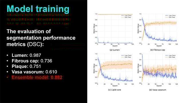 Intracoronary image interpretation: from operator to artificial intelligence