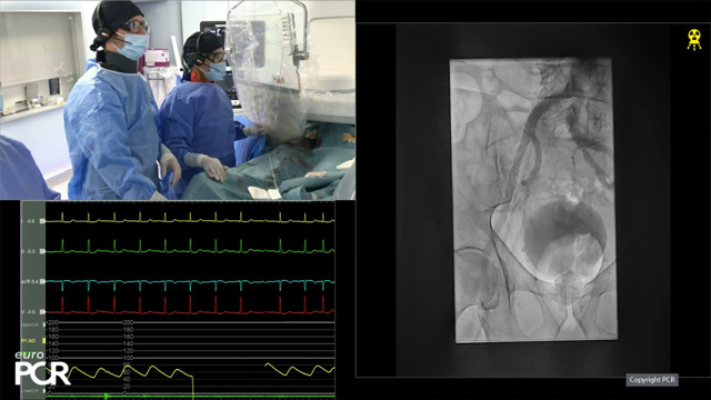 Myval Octapro THV - Optimise patient outcomes with novel design, data and daily clinical practice
