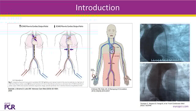 Novel tools and strategies for acute heart failure