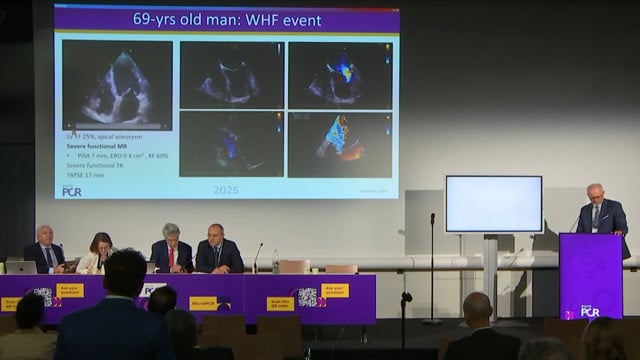 Refractory heart failure: combining oral therapy and device is key