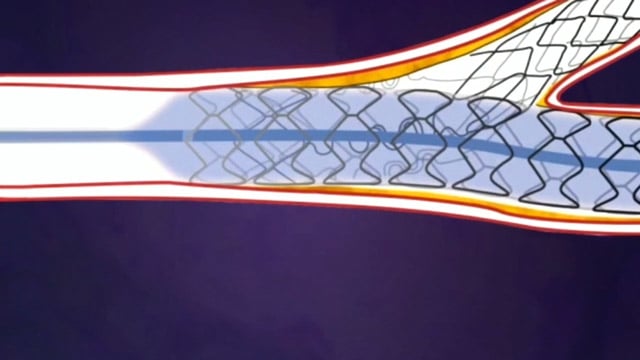 Shaping the future of cardiology - A journey of meaningful innovation in structural heart and coronary