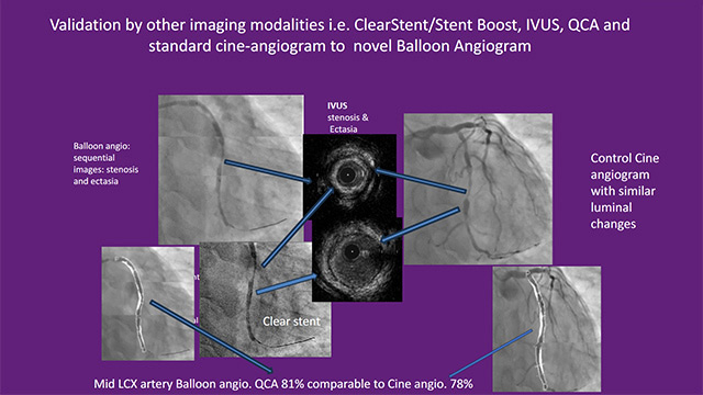 Tough cases, smart imaging