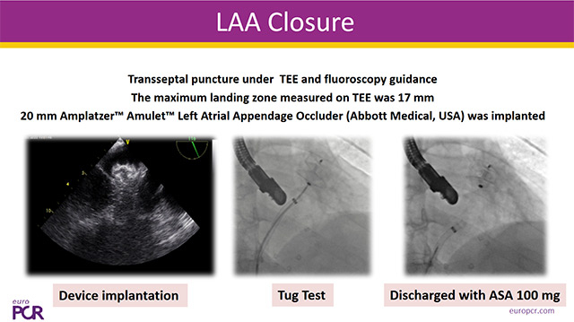 Troubleshooting and management communication in LAA closure