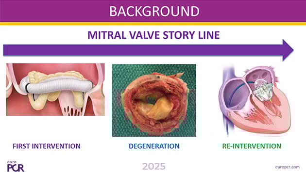Updates in transcatheter MVR