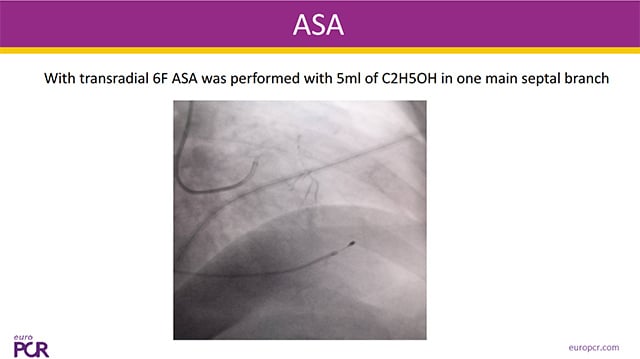 Venous system under the spotlight: challenging clinical cases