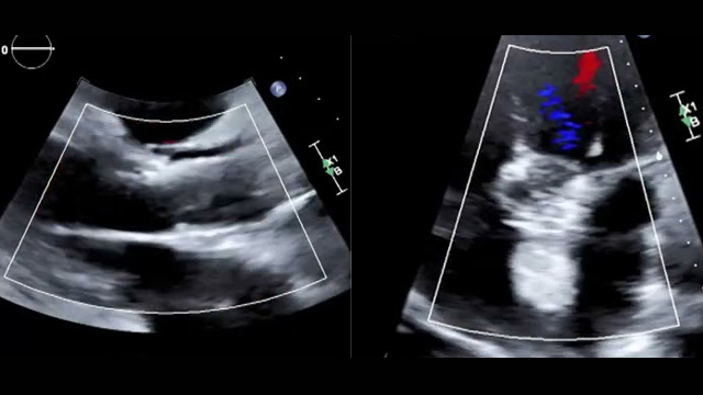 Beyond the horizon - Shaping the future of cardiology through meaningful innovation in structural heart and coronary