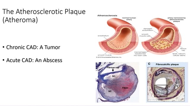 Beyond the trial: how will SELUTION DeNovo redefine our PCI practice?