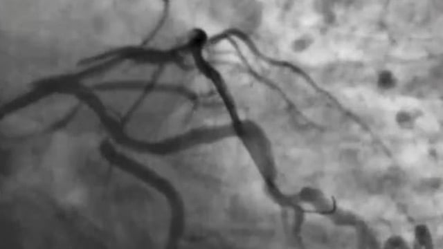 Challenging cases from the East