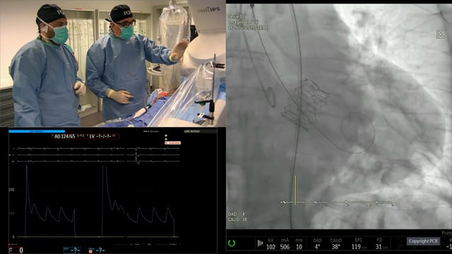 Align for the future with next gen Myval transcatheter heart valve series