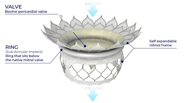 Featured research - Mitral valve interventions: Physiology & device innovation