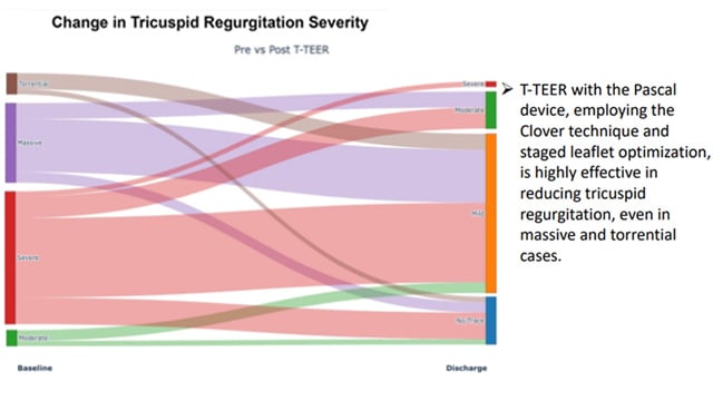 Featured research - Tricuspid valve intervention: latest advanced insights