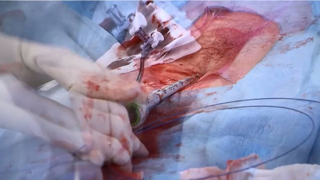 The Top Late-Breaking Trials - Part 2