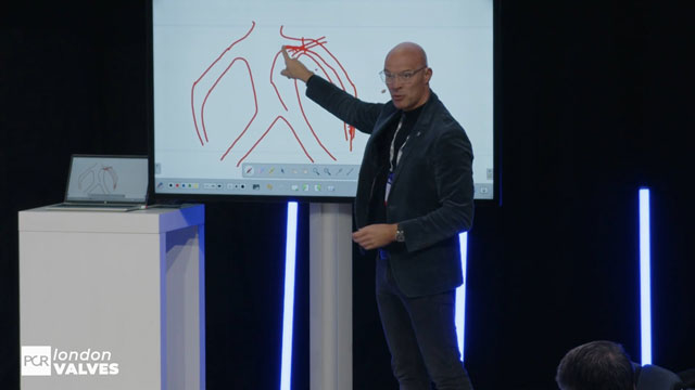 Meet the masters: complex TAVI