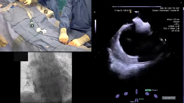 Redefining and optimising LAA closure - LIVE Case