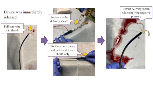 LAA closure
