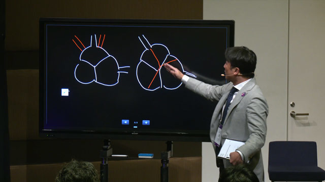 Lifetime management with self-expandable valve based on the latest evidence